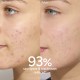Caudalie Vinopure Salicylic Spot Solution Κρέμα Τοπικής Εφαρμογής Για Σπυράκια & Ερυθρότητα 15ml