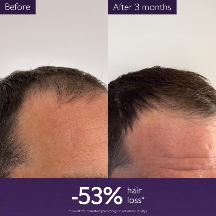 CAUDALIE  Anti-Hair Loss Serum