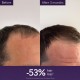 CAUDALIE  Anti-Hair Loss Serum